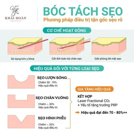 boc tach seo