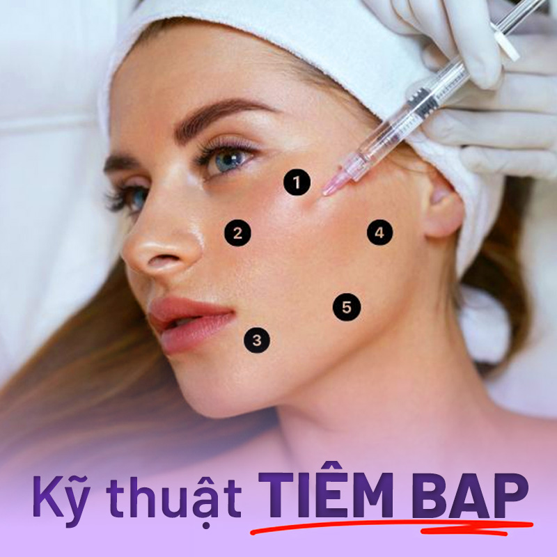 tiem BAP