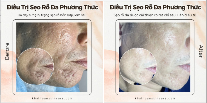 1 lieu trinh seo ro 2