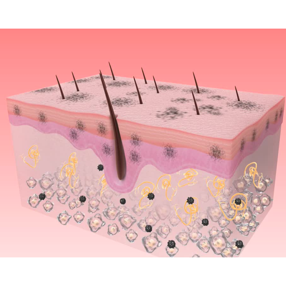 nguyen nhan hinh thanh nam da 1