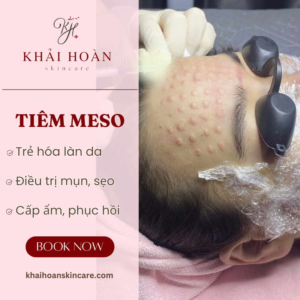 tiem meso bao nhieu 1 lan 1
